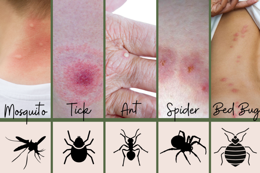 Common Bug Bites